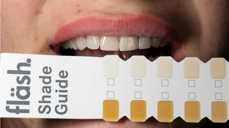 Before You Whiten: 5 Questions to Ask Your Dentist First