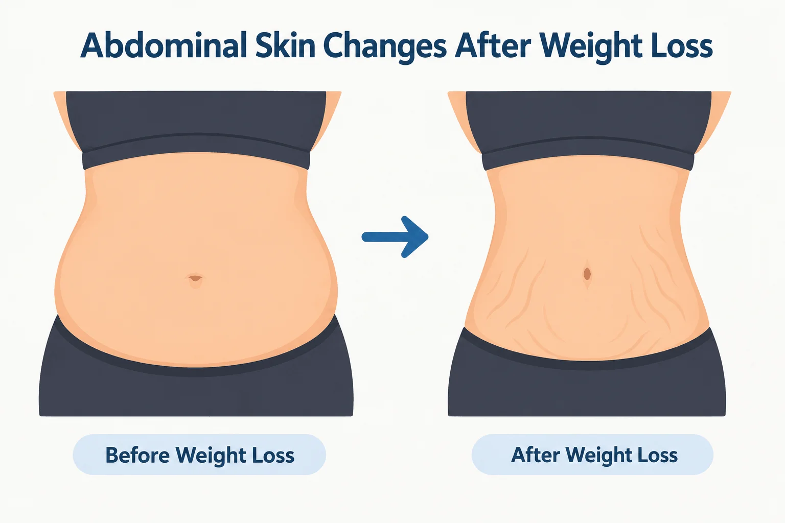 Skin Changes After Weight Loss